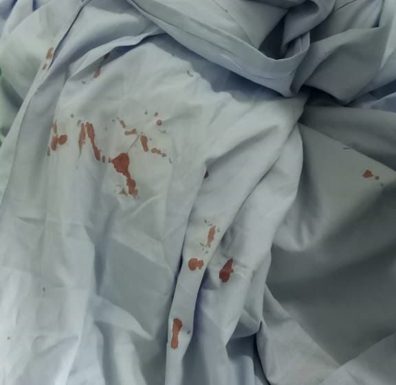  Técnica de Enfermagem é agredida com estilhaços de vidro em Maternidade de Teresina