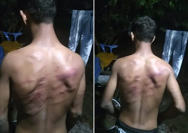  Adolescente de 16 anos conta ter sido agredido por grupo de elite da Guarda Municipal de Teresina