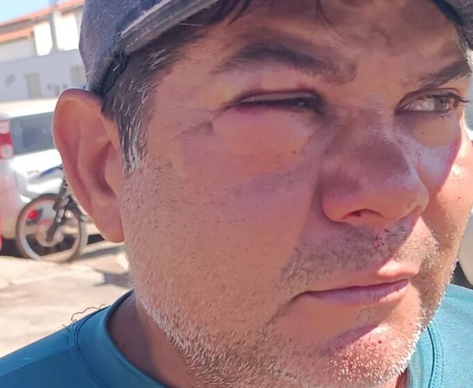 Servidor de prefeitura é agredido ao recolher gado solto na rua; suspeito é dono dos animais